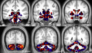 Illustration for article titled Estas son las imágenes más detalladas del cerebro jamás tomadas